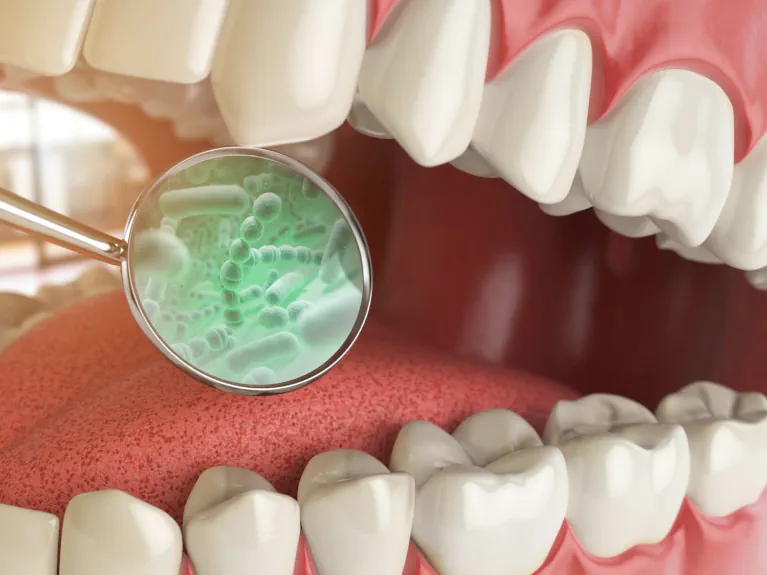 Bad breath and halitosis treatment at Handcrafted Smiles in Arlington Heights, IL