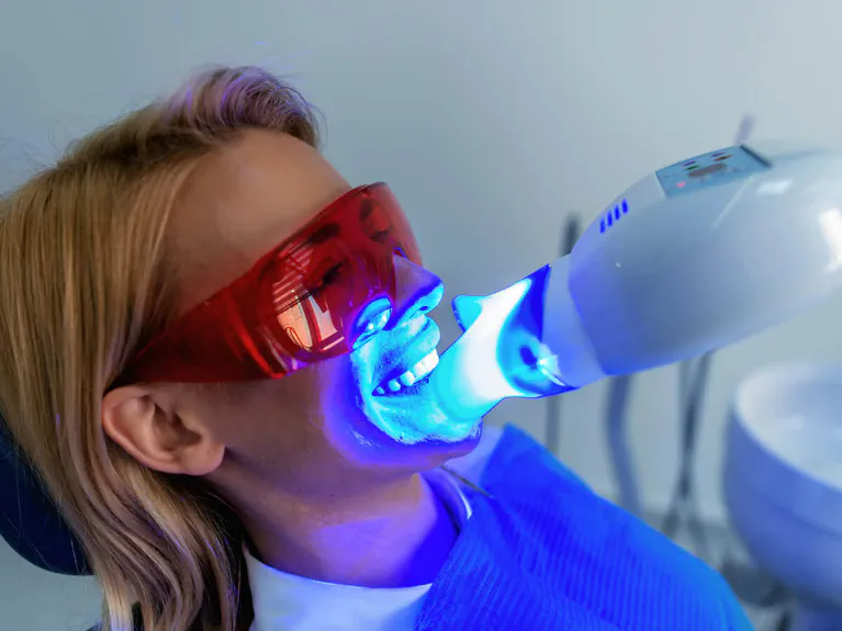 Teeth whitening services at Handcrafted Smiles in Arlington Heights, IL
