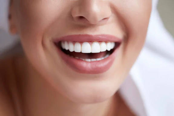 How to care for dental veneers near Arlington Heights, IL at Handcrafted Smiles